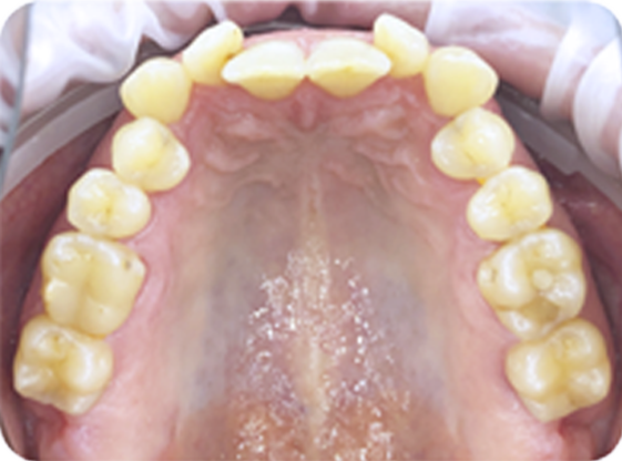 smile care bd before and after